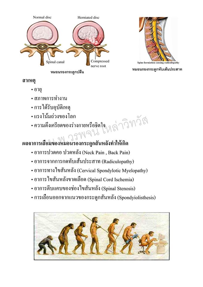 AJWorapojn 5